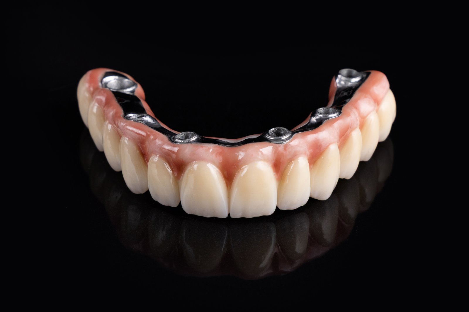 Dynamic Dent fogtechnikai munka